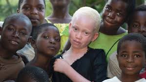 4 Sentenced to death for albino killing