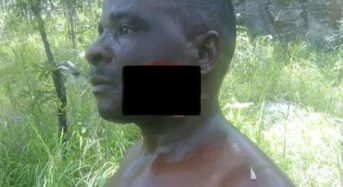 Forestry scout ranger hacked by angry charcoal producers in Machinga